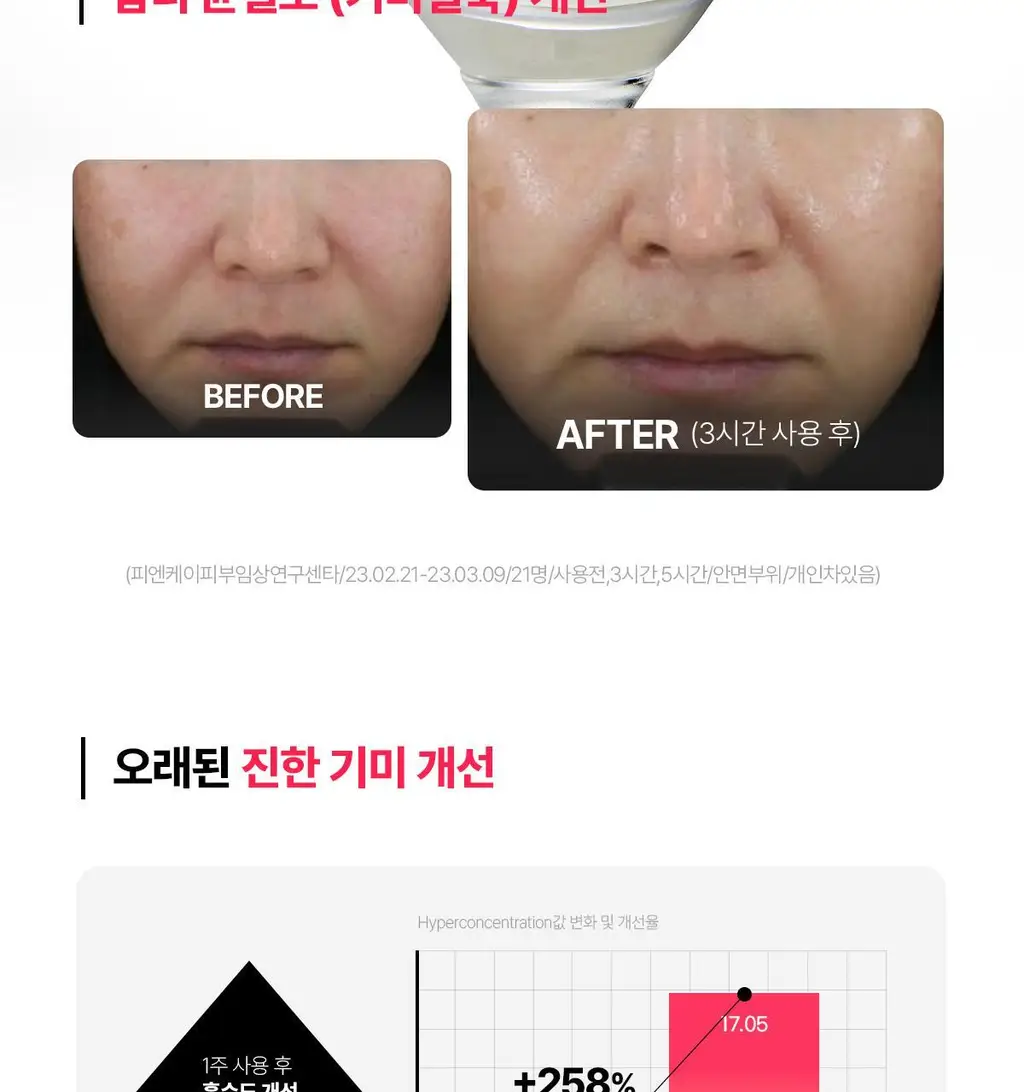 [기미잡티/대용량] 센텔리안24 엑스퍼트 마데카 멜라 캡처 앰플 맥스 30ml 더블 기획 상세페이지 7